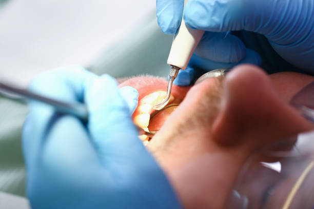 Best Knocked-Out Tooth Emergency  in Chandler, OK